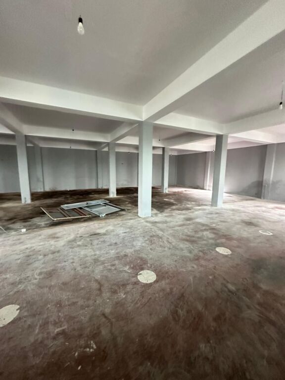 JEPET ME QERA AMBIENT BIZNESI PRANE SPITALI, DURRES